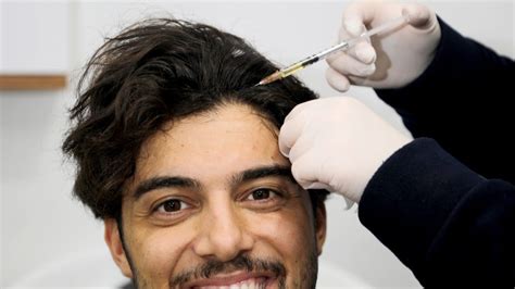 PRP: Een Natuurlijke Aanpak Voor Haarherstel